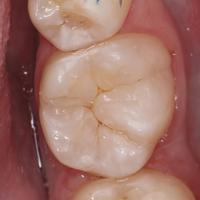 Пример работы до и после -