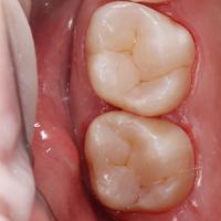 Пример работы до и после -