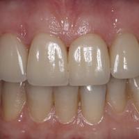 Пример работы до и после -