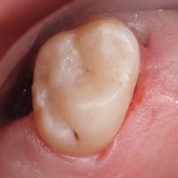 Пример работы до и после -