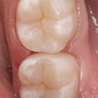 Пример работы до и после -