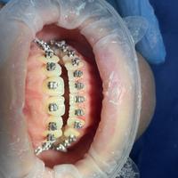 Пример работы до и после - 