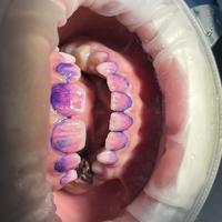 Пример работы до и после - 