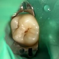 Пример работы до и после -