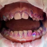 Пример работы до и после -