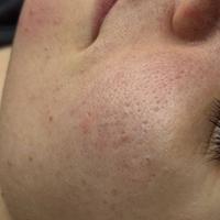 Пример работы до и после - 