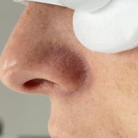 Пример работы до и после - 