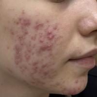 Пример работы до и после - 