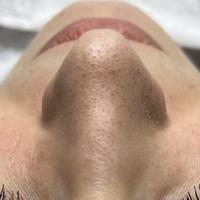 Пример работы до и после - 