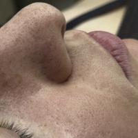 Пример работы до и после - 