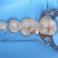 Пример работы до и после -