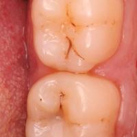 Пример работы до и после - 