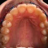 Пример работы до и после - 