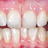 Пример работы до и после - 