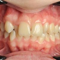 Пример работы до и после -