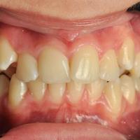 Пример работы до и после -