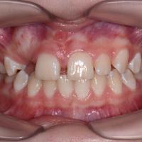 Пример работы до и после - 