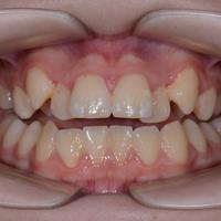 Пример работы до и после - 