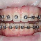 Пример работы до и после - 