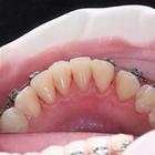 Пример работы до и после - 