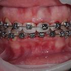 Пример работы до и после - 