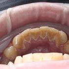 Пример работы до и после - 