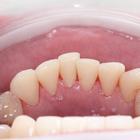 Пример работы до и после - 