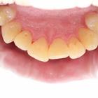 Пример работы до и после - 