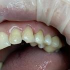 Пример работы до и после - 