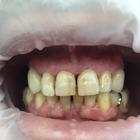 Пример работы до и после - 