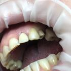 Пример работы до и после - 