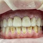 Пример работы до и после - 