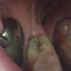 Пример работы до и после - 