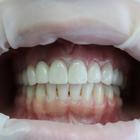 Пример работы до и после - 