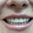 Пример работы до и после - 