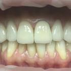 Пример работы до и после - 