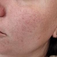 Пример работы до и после - 