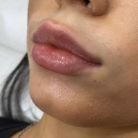 Пример работы до и после - 