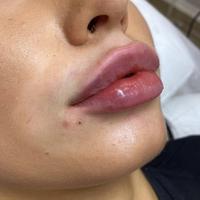 Пример работы до и после - 