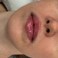 Пример работы до и после - 