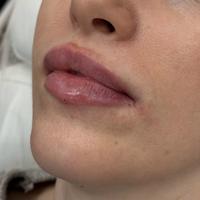 Пример работы до и после - 