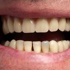 Пример работы до и после - 