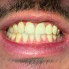 Пример работы до и после - 