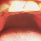 Пример работы до и после - 