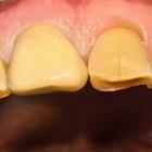 Пример работы до и после - 