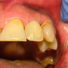 Пример работы до и после - 