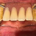 Пример работы до и после - 