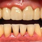 Пример работы до и после - 