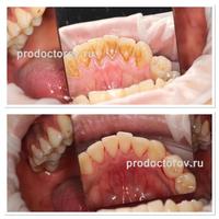 Пример работы до и после - 