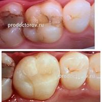 Пример работы до и после - 